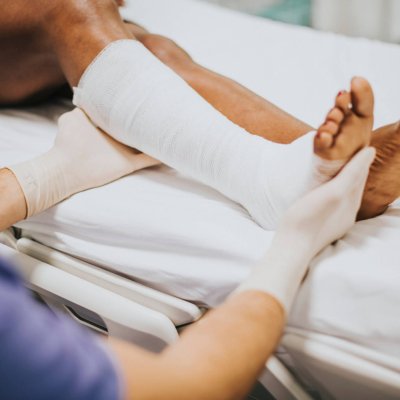 Doctor helping a patient with a fractured leg