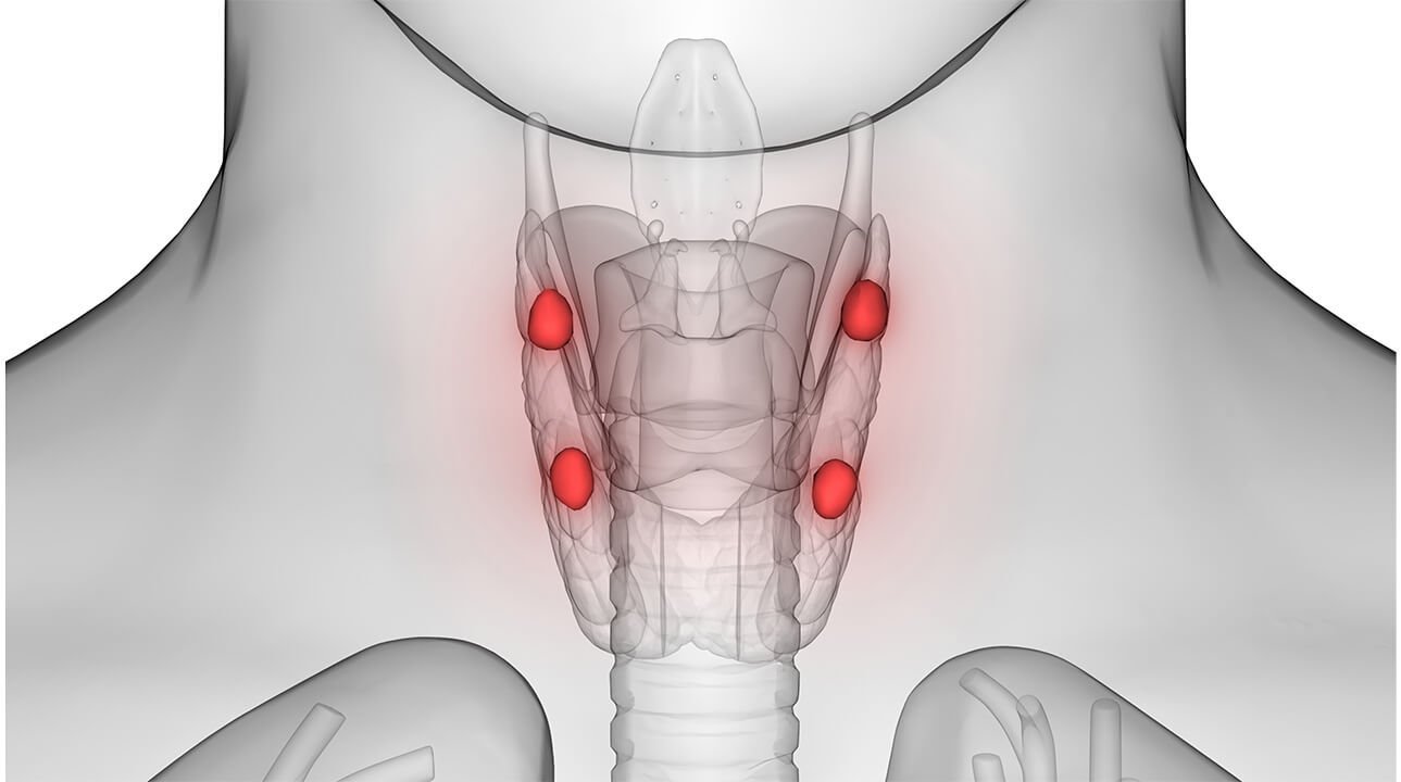 NW Parathyroid Graphic 1289X720