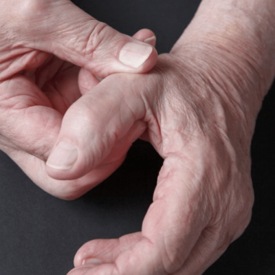 PHWE-Thumb-Base-Pain-1-1