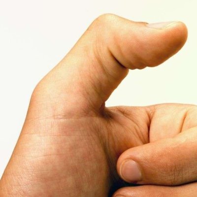 Trigger-thumb