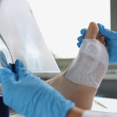 Doctor medical examination with leg injury and x-ray. Sprained and fractured feet concept